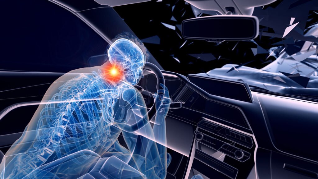 Best Physiotherapist for Car Accident Injuries